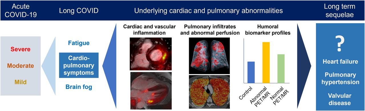 image des anomalies cardiaques et pulmonaires covid aigu, covid long et sequelles à long terme